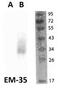 FR-beta antibody, NBP2-62208, Novus Biologicals, Western Blot image 