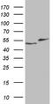 RAD23 Homolog B, Nucleotide Excision Repair Protein antibody, TA804896, Origene, Western Blot image 