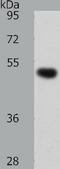 SMAD Family Member 5 antibody, TA323512, Origene, Western Blot image 