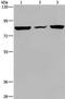 Prolyl 3-Hydroxylase 3 antibody, PA5-50439, Invitrogen Antibodies, Western Blot image 