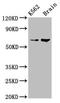 BRCA1-associated protein antibody, LS-C671666, Lifespan Biosciences, Western Blot image 