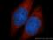 Protein LYRIC antibody, 13860-1-AP, Proteintech Group, Immunofluorescence image 