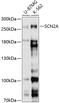 Sodium Voltage-Gated Channel Alpha Subunit 2 antibody, 13-732, ProSci, Western Blot image 