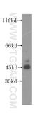 HPD antibody, 17004-1-AP, Proteintech Group, Western Blot image 
