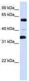 Zinc finger protein with KRAB and SCAN domains 1 antibody, TA342430, Origene, Western Blot image 