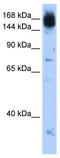 Non-SMC Condensin I Complex Subunit D2 antibody, TA339319, Origene, Western Blot image 