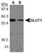 Solute carrier family 2, facilitated glucose transporter member 1 antibody, TA301678, Origene, Western Blot image 