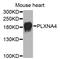 Plexin-A4 antibody, STJ112031, St John