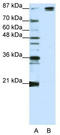 SF3b155 antibody, TA345712, Origene, Western Blot image 