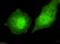 Transducin Beta Like 1 X-Linked Receptor 1 antibody, GTX49189, GeneTex, Immunocytochemistry image 