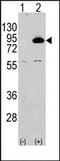 Phosphoinositide-3-Kinase Regulatory Subunit 2 antibody, AP14949PU-N, Origene, Western Blot image 