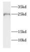 Fetal And Adult Testis Expressed 1 antibody, FNab03022, FineTest, Western Blot image 
