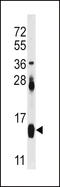 Fatty Acid Binding Protein 4 antibody, MBS9210294, MyBioSource, Western Blot image 