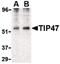 Perilipin-3 antibody, PA5-20273, Invitrogen Antibodies, Western Blot image 