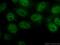 RB Transcriptional Corepressor 1 antibody, 25628-1-AP, Proteintech Group, Immunofluorescence image 