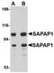 Disks large-associated protein 1 antibody, orb74998, Biorbyt, Western Blot image 