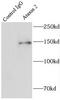 Ataxin 2 antibody, FNab00657, FineTest, Immunoprecipitation image 