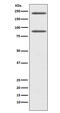 Complement C4A (Rodgers Blood Group) antibody, M01095-2, Boster Biological Technology, Western Blot image 