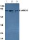 FAST Kinase Domains 5 antibody, A12596, Boster Biological Technology, Western Blot image 