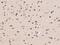 EEF1A Lysine Methyltransferase 3 antibody, 205088-T10, Sino Biological, Immunohistochemistry paraffin image 