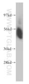 Serine hydroxymethyltransferase, cytosolic antibody, 14149-1-AP, Proteintech Group, Western Blot image 