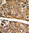 Malate dehydrogenase, cytoplasmic antibody, A04262-1, Boster Biological Technology, Immunohistochemistry paraffin image 