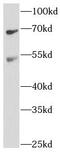 Bestrophin-1 antibody, FNab00866, FineTest, Western Blot image 