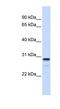 Family With Sequence Similarity 78 Member B antibody, NBP1-55527, Novus Biologicals, Western Blot image 