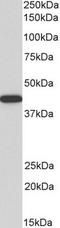 Alpha-Methylacyl-CoA Racemase antibody, TA329674, Origene, Western Blot image 
