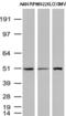 Thymidine Phosphorylase antibody, UM870021, Origene, Western Blot image 