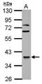 3-Oxoacyl-ACP Synthase, Mitochondrial antibody, GTX124011, GeneTex, Western Blot image 