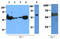 Pyruvate Kinase M1/2 antibody, AM50349PU-N, Origene, Western Blot image 