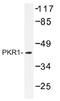 Protein Kinase CAMP-Dependent Type I Regulatory Subunit Alpha antibody, AP01335PU-N, Origene, Western Blot image 