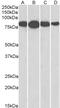 Radixin antibody, PA5-18542, Invitrogen Antibodies, Western Blot image 