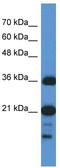 SUZ RNA Binding Domain Containing 1 antibody, TA333801, Origene, Western Blot image 