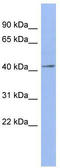 ELAV Like RNA Binding Protein 4 antibody, TA343909, Origene, Western Blot image 