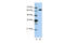 Lysyl-TRNA Synthetase antibody, 29-355, ProSci, Western Blot image 