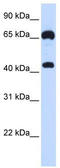 Guanylate Cyclase 1 Soluble Subunit Beta 1 antibody, TA338967, Origene, Western Blot image 