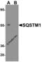 Sequestosome 1 antibody, 5449, ProSci Inc, Western Blot image 