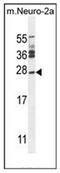 Josephin Domain Containing 2 antibody, AP52274PU-N, Origene, Western Blot image 