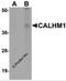 Calcium Homeostasis Modulator 1 antibody, 5593, ProSci, Western Blot image 