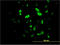 HNF-3-beta antibody, LS-B5424, Lifespan Biosciences, Immunofluorescence image 