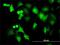 Protein Phosphatase, Mg2+/Mn2+ Dependent 1B antibody, H00005495-M01, Novus Biologicals, Immunocytochemistry image 