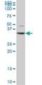 2,4-Dienoyl-CoA Reductase 2 antibody, H00026063-B01P, Novus Biologicals, Western Blot image 