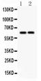 SLC22A2 antibody, PB9394, Boster Biological Technology, Western Blot image 