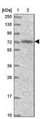 GPI mannosyltransferase 3 antibody, PA5-58993, Invitrogen Antibodies, Western Blot image 
