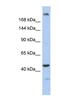 Centrosomal Protein 170B antibody, NBP1-79577, Novus Biologicals, Western Blot image 