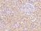 Kelch Like Family Member 25 antibody, 205174-T10, Sino Biological, Immunohistochemistry paraffin image 