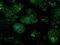 Isocitrate Dehydrogenase (NAD(+)) 3 Alpha antibody, NBP2-02158, Novus Biologicals, Immunofluorescence image 