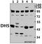 Deoxyhypusine Synthase antibody, A02106-1, Boster Biological Technology, Western Blot image 